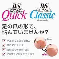 【新規限定】巻き爪矯正・BS 1本コース