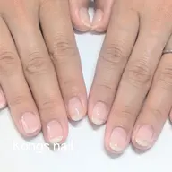【深爪/ちび爪ケア】自爪育成コース