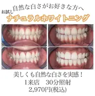 【初回体験✨】お試しセルフホワイトニング計30分照射 痛みなく自然な白さへ