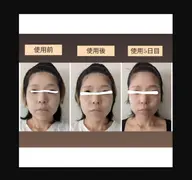 EMS搭載!3in1美顔器使用のトリートメント