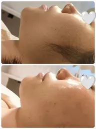 🥀フェイスWax&鎮静パック