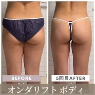【痩身】エステ版オンダリフトBODY2箇所 【お腹・二の腕・腰・おしり・太もも(表or裏)】