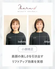 【ミニモ期間限定|口コミ投稿限定】小顔矯正+全身姿勢矯正 60分 ¥6,000