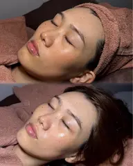 🎀*॰ॱ透明感UP光肌ケア🎀*肌がパッと明るく見えるケア🧏🏻♀️✨ニキビ跡・赤み・くすみに集中ケア🪄︎︎◝✩