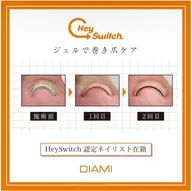【フット】巻き爪ケア1本¥5500