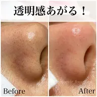 2回目からこちら💁♀️💕【毛穴エクストラクション】70分¥7,400