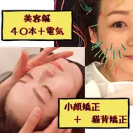 【40本使用】美容鍼+小顔矯正+猫背矯正🌟スタンダードコース