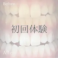 【ミニモSALE】うる艶美白歯🦷初回体験✨40分¥2500ホワイトニングデビューは当店におまかせ✨口コミ必須🫶
