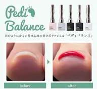 ［foot］ペディバランス　巻爪矯正しながらネイルを楽しめるジェルネイル‼︎
