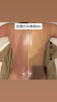 🫧【25歳以下限定】シークレットYボディケア