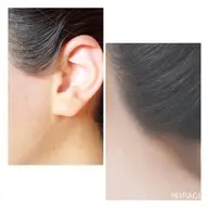 うなじ&襟足（衣紋抜き部分まで）&もみ上げwax＋保湿パック付き✨（初回）
