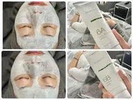 肌質改善コース💆♀️🌿【クレンジング→ホットマスク→クリームマスク→マッサージ】