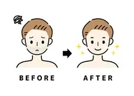 ⭐️ミニモ限定⭐️毎日5分の髭剃りからの卒業★ヒゲ＋顔　男性5000円