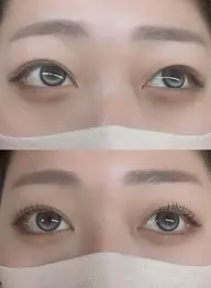 マツパ