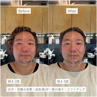【整形なしで小顔‼️】お顔の歪みを整える「骨格補正スパ」🍀.*