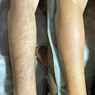【メンズ👱🏼♂️腕】ブラジリアンワックス🍯面倒な自己処理なしでその場でスッキリ✨半袖を着る夏の時期に⭕️