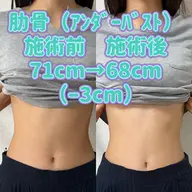 筋肉トリートメントコース（肋骨締め・骨盤締め）40分