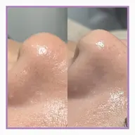 フェイシャルワックス🕊産毛・角質ケアでトーンアップ&化粧ノリUP💕