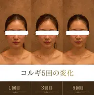 【1回の施術で首長効果と小顔を実感】本格コルギ+肩甲骨剥がし+デコルテ流し 50分