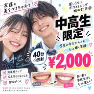 🎓中高生限定✨学生の今こそ白い歯に🦷40分セルフホワイトニング¥2,000💕