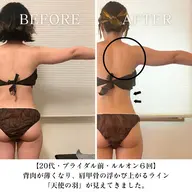 【ブライダル】LULUONN+背中・腕集中してマッサージ♪NMN高濃度パック¥8800→¥7800