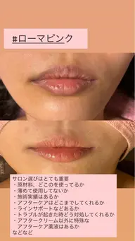 🩷ローマピンク🩷　無料カウンセリング予約はこちら！リップ　半額キャンペーﾝアフタークリーム込み85000円！