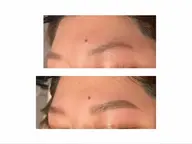 レディース限定👩‍🦰ハリウッドブロウリフト