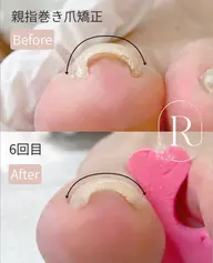 【FOOTケア】親指1本ネイルケア¥4400