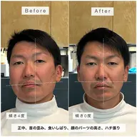 【7月限定】ととのう小顔 / 骨格補正スパ💆🏻♀️🫧
