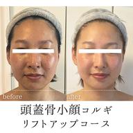 リフトアップコース【即小顔実感リフトアップ】頭蓋骨小顔コルギ60分