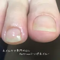 【フット】極上ネイルケア