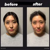 本場韓国全身コルギ🦴|姿勢・小顔・歪み・むくみ・改善コース💆🏼♀️/口コミ投稿してくれる方次回炭酸パック付き✨
