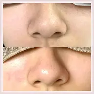 毛穴ケアフェイシャルマッサージ、フェイスパック付き💆♀️補足を必ず読んでください。動画、写真撮影有り