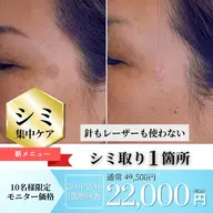 💎シミ取り1箇所(2cm×2cm)
