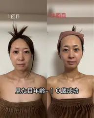 【温熱マシン✨極上の癒やし】フェイシャル+デコルテ温熱ケア♡深部からじんわりポカポカ✨