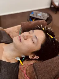 頭皮鍼×ドライヘッドスパ(脳疲労/不眠/自律神経/頭痛)