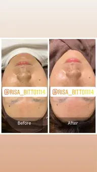 フェイスWax