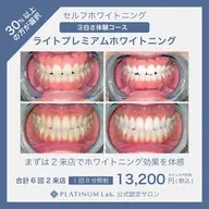 ✨ライトプレミアムホワイトニング✨(2来店60分照射〈1来店目20分/2来店目40分〉となります)