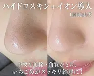 【+美容液導入で開き毛穴引き締め】毛穴洗浄(全顔)&導入 9900円