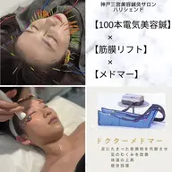 人気No,1！鍼100本使用！リフトアップ、エラ改善【鍼100本】×【電気】×【小顔筋膜リフト】約90分