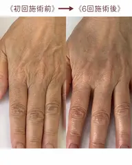 【手の乾燥・年齢による手元の変化に】大人の手元ケア｜自分の手を大切にしたい方へ