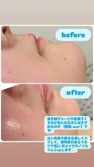 つるんと卵肌🌹産毛角質除去💎艶肌Wax💎
