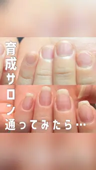 【平日割】自爪・深爪育成【カウンセリング・ケアオイル込】深爪矯正ご検討の方もコチラ✨