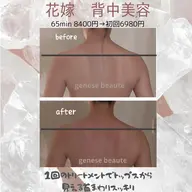 《花嫁美容》お洋服がスッキリ着こなせる お背中×デコルテ×腕の集中ボディメイク 《重い肩こりにも》