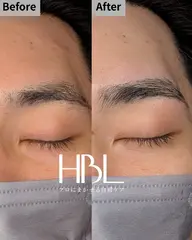 HBL(ワックス脱毛込み)
