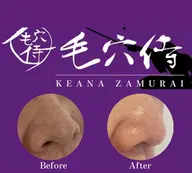人気No.1【初回必須】【松ヤニパック】【毛穴侍】お得3セット