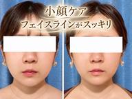 🌸美容整体コース｜小顔矯正ケア