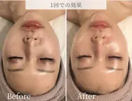 ミニモ限定価格!【憧れのツヤ肌へ✨】毛穴・ニキビ・くすみ・乾燥・シワケアなどのお悩みにアプローチ!