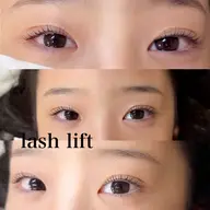マツパ