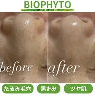 💚毛穴ケア(黒ずみ/開き/皮脂)ニキビケアに🌿肌活力UPハーブピーリング｜クリスティーナ“ビオフィート”60分